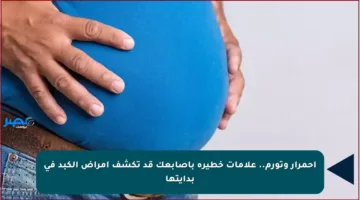 احمرار وتورم.. علامات خطيرة بأصابعك قد تكشف أمراض الكبد في بدايتها